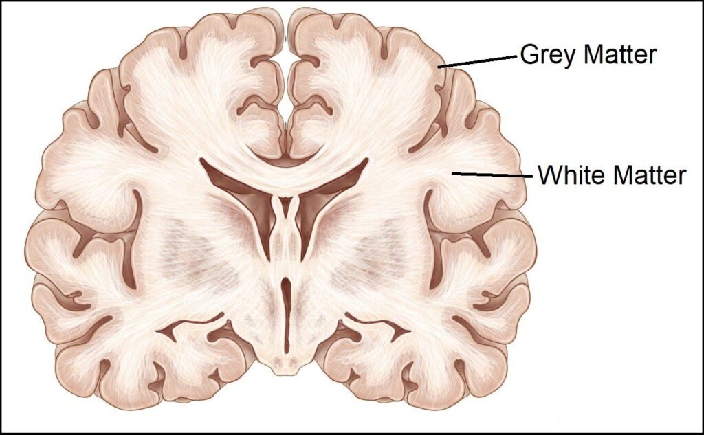 Brain Cross Section