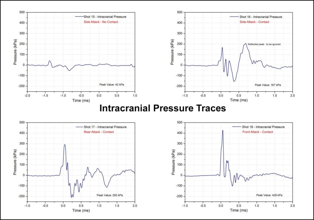 Intracranial Pressures, measured pressure traces